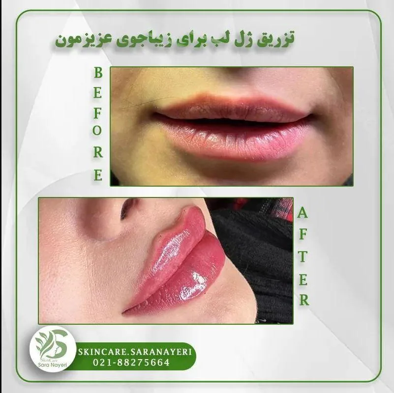 مجموعه زیبایی پوست و مو سارا نیری