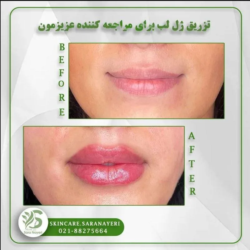 مجموعه زیبایی پوست و مو سارا نیری - تصویر 2
