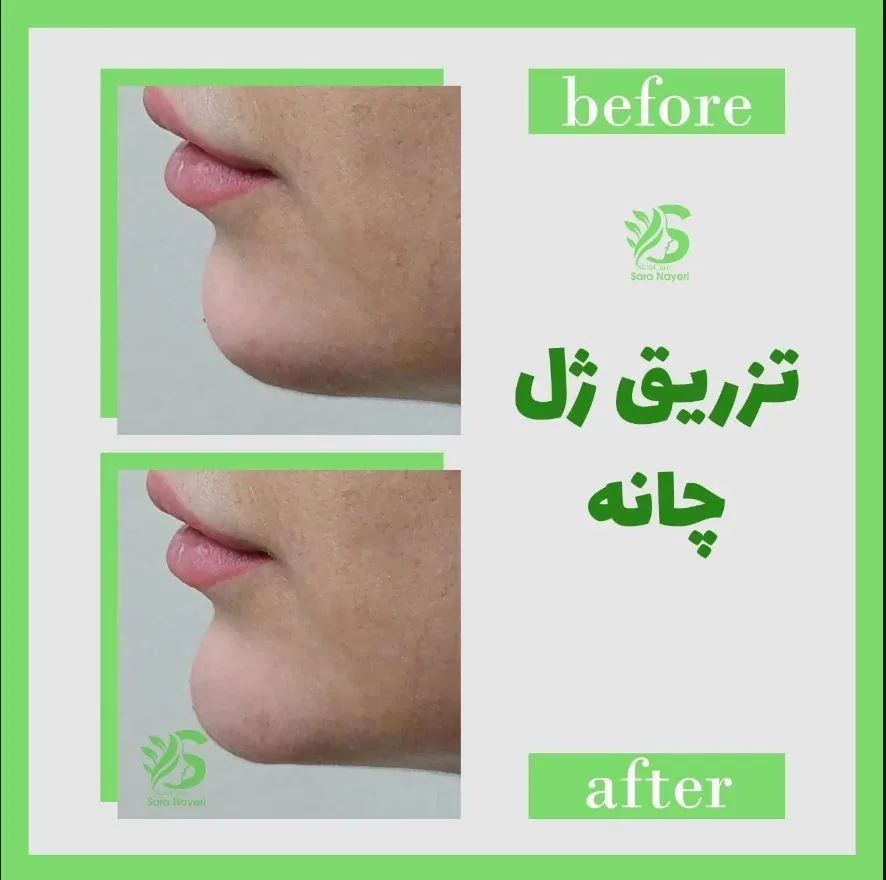 مجموعه زیبایی پوست و مو سارا نیری - تصویر 3