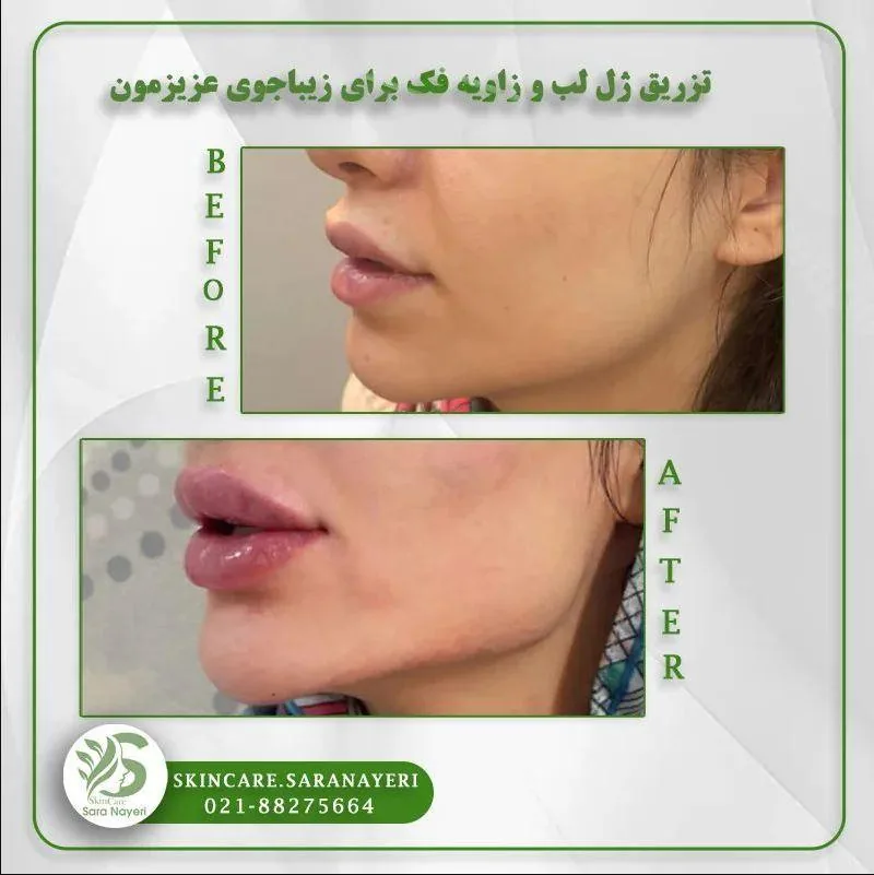 مجموعه زیبایی پوست و مو سارا نیری - تصویر 4