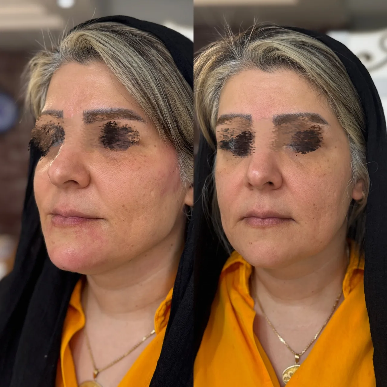 مرکز لیزر، پوست و مو نچرال بیوتی - تصویر 2