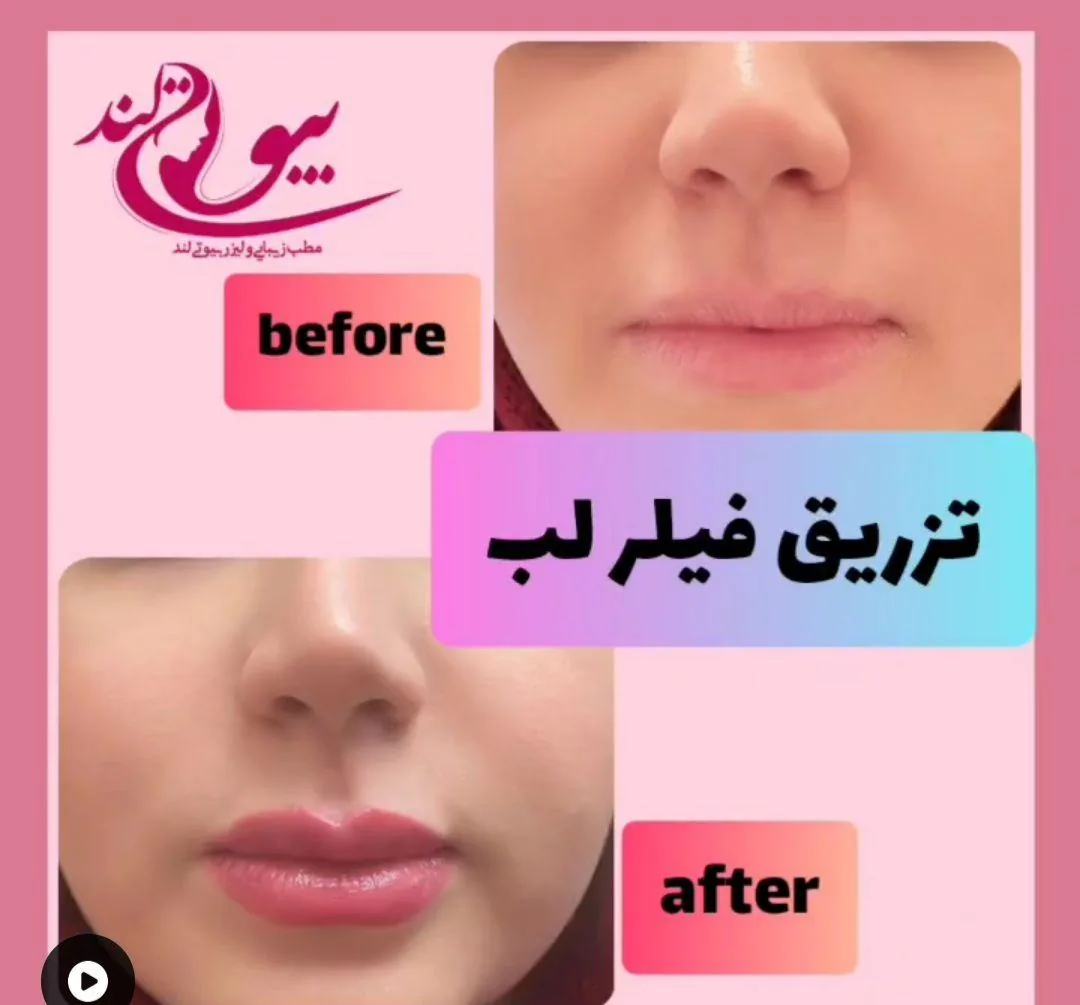 مجموعه پوست مو زیبایی بیوتی لند شریعتی