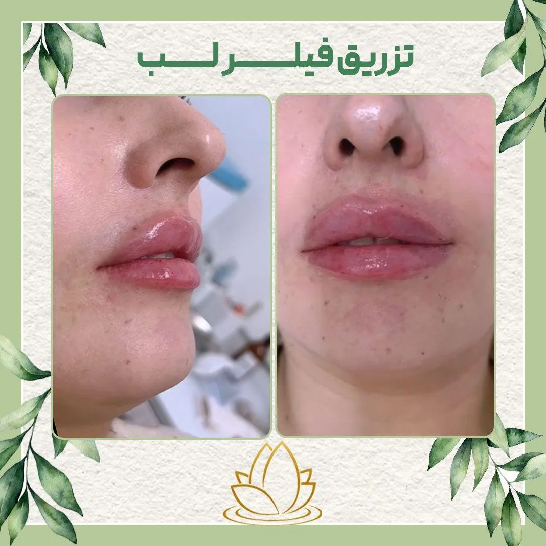 مرکز پوست ،مو و زیبایی رایا - تصویر 3