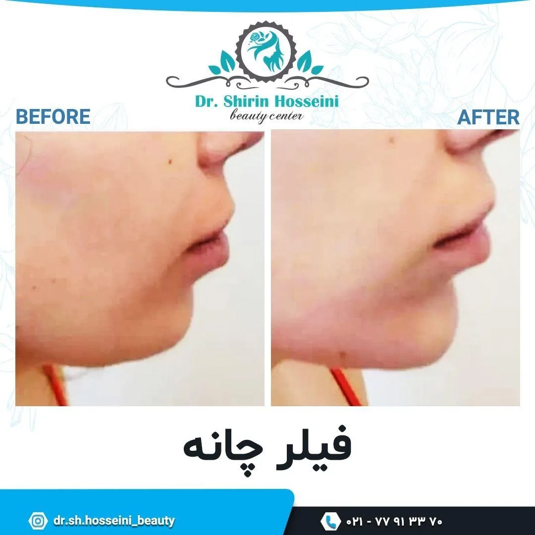 کلینیک پوست و مو زیبایی و لیزر مهرآفرین - تصویر 2