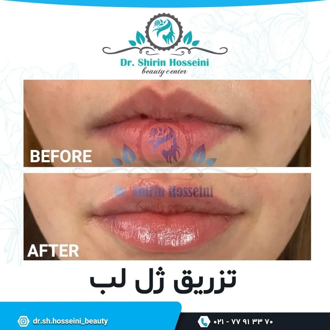 کلینیک پوست و مو زیبایی و لیزر مهرآفرین - تصویر 3