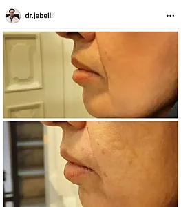 کلینیک زیبایی و لیزر بادوم