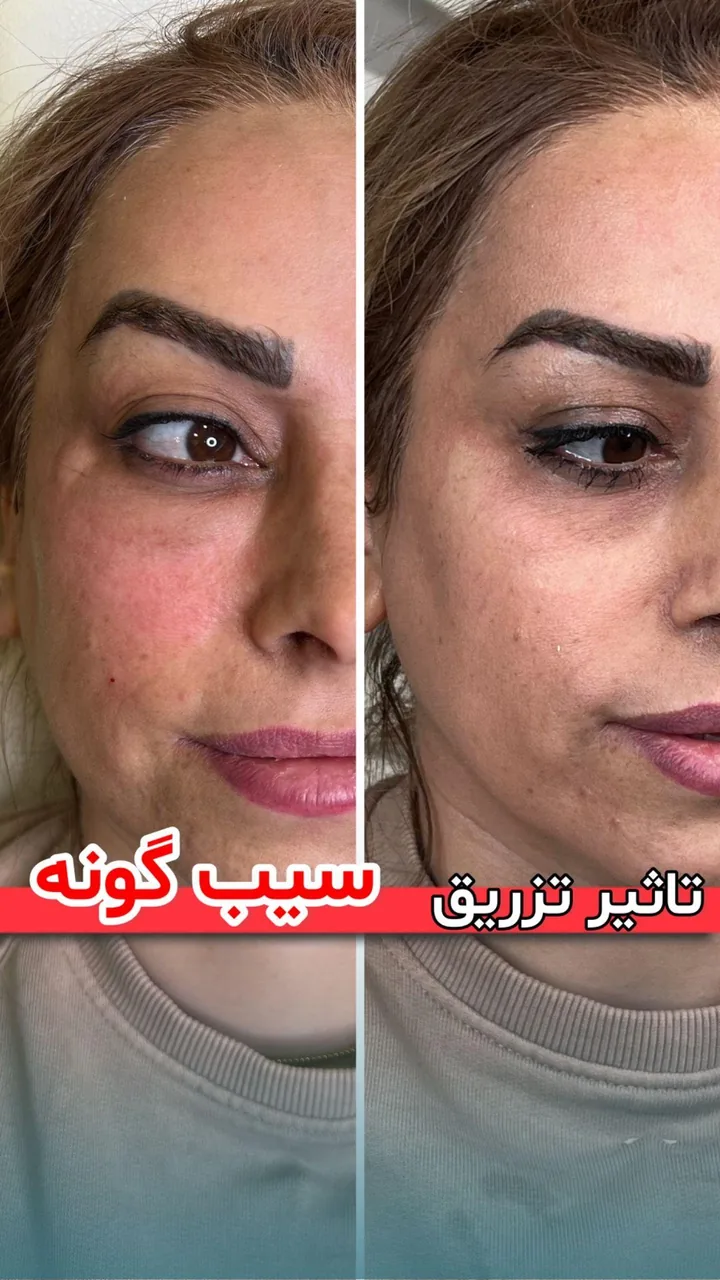 مرکز پوست،لیزر و زیبایی اوپال - تصویر 2