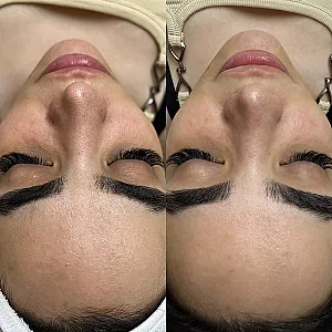 فیشال تخصصی پارمیدا