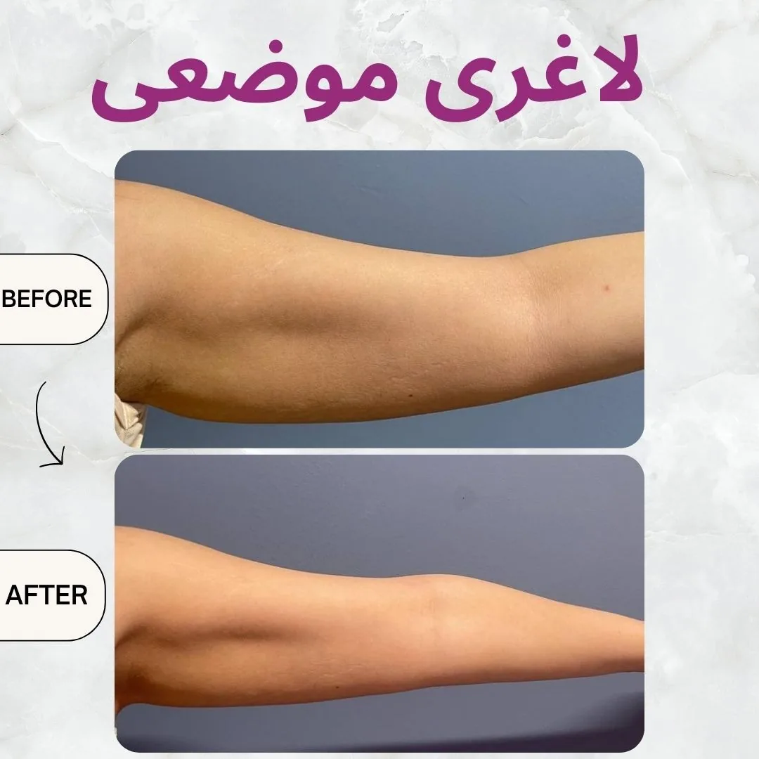 مرکز زیبایی، لیزر و تناسب اندام لبخند - تصویر 3