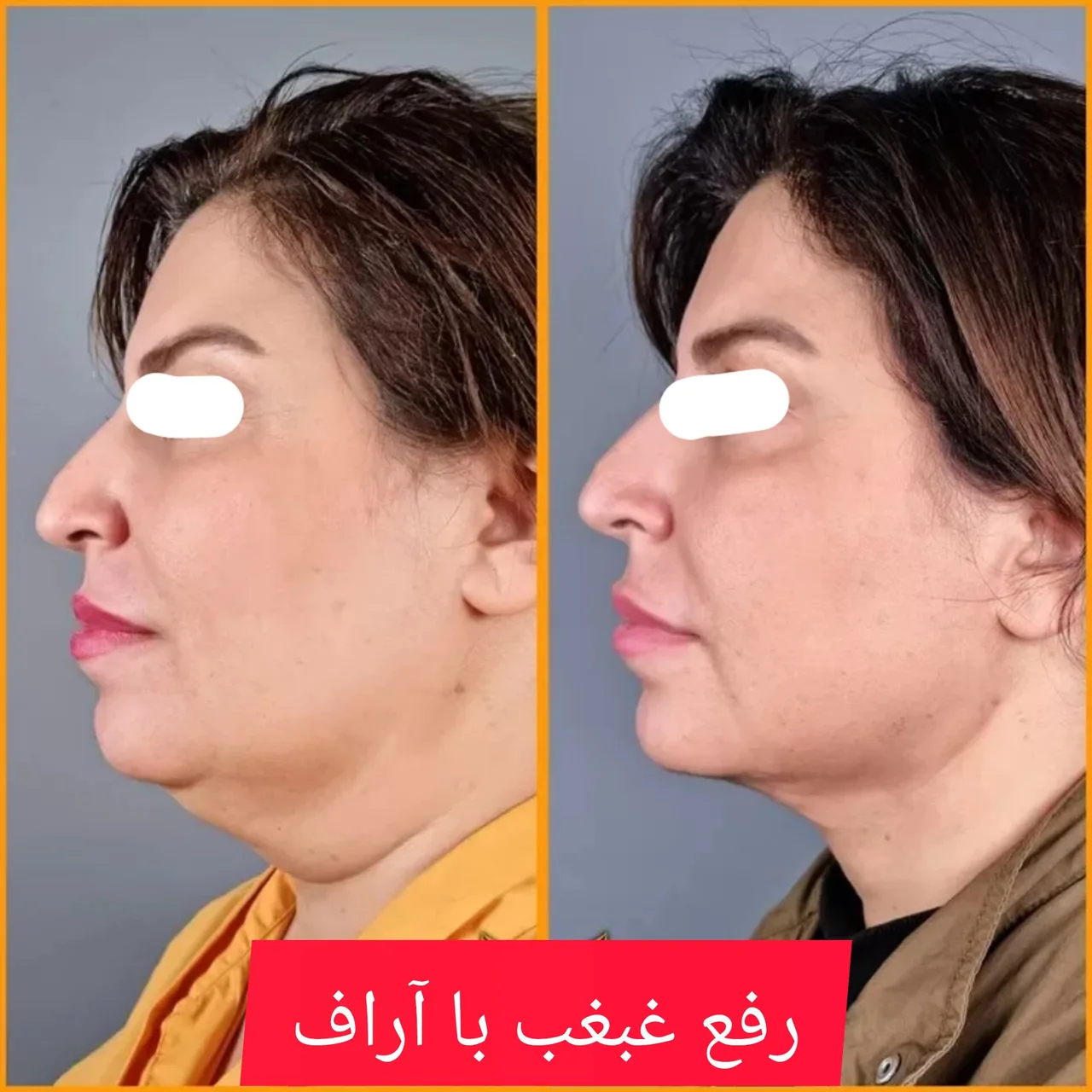 مرکز زیبایی، لیزر و تناسب اندام لبخند - تصویر 4