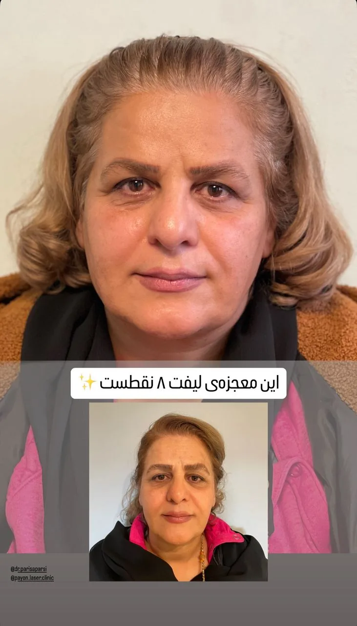 کلینیک لیزر وکلینیک زیبایی پایون(بانوان) - تصویر 3