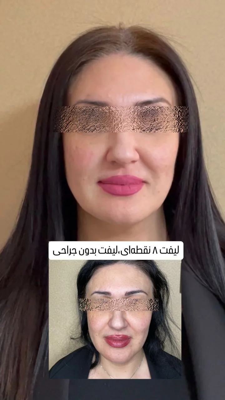 کلینیک لیزر وکلینیک زیبایی پایون(بانوان) - تصویر 4