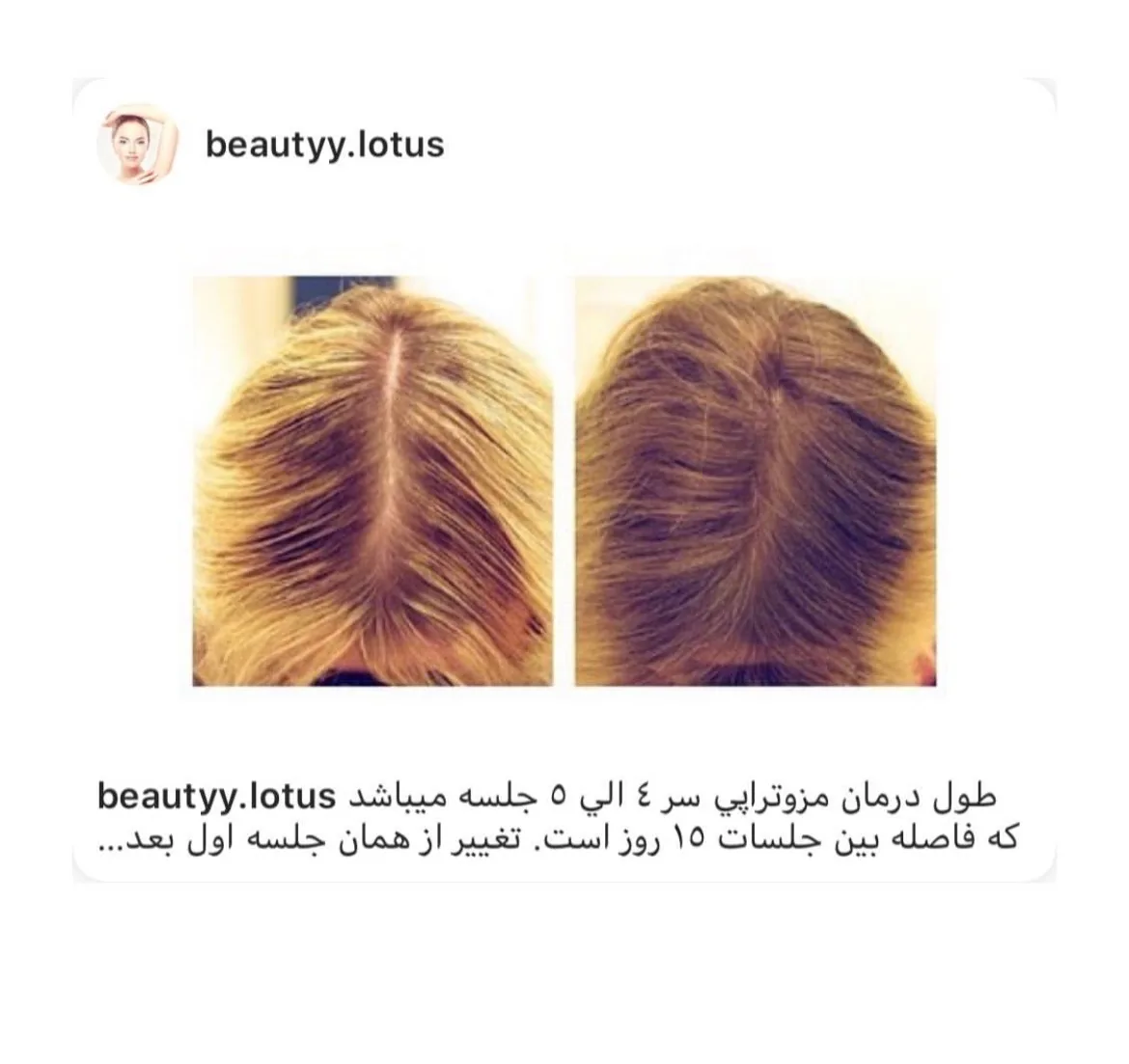 کلینیک پوست و مو و لیزر نیلوفر آبی - تصویر 2