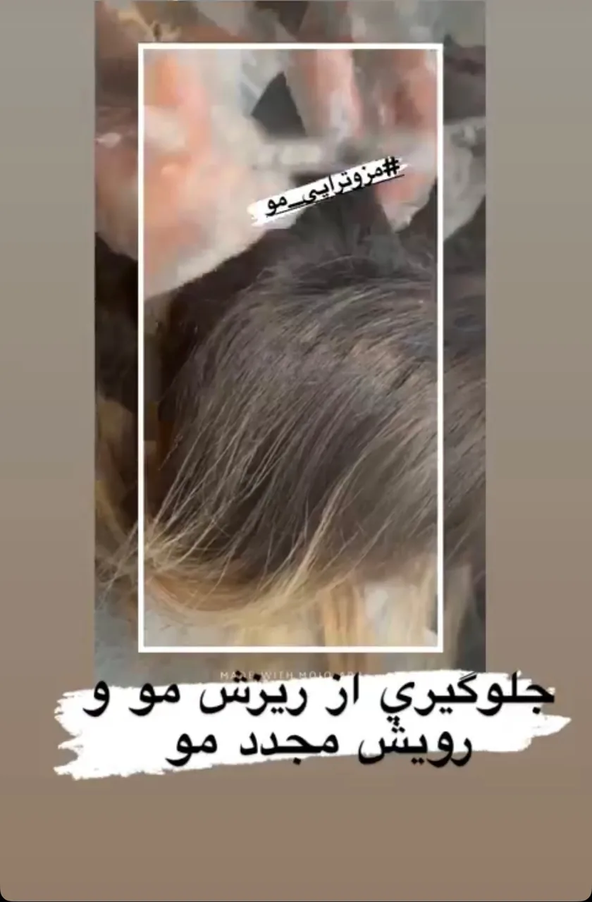 کلینیک پوست و مو و لیزر نیلوفر آبی - تصویر 3