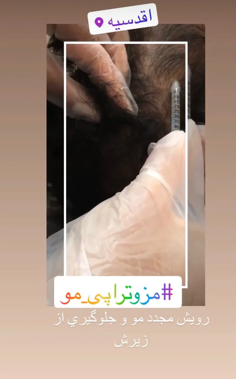 کلینیک پوست و مو و لیزر نیلوفر آبی - تصویر 4