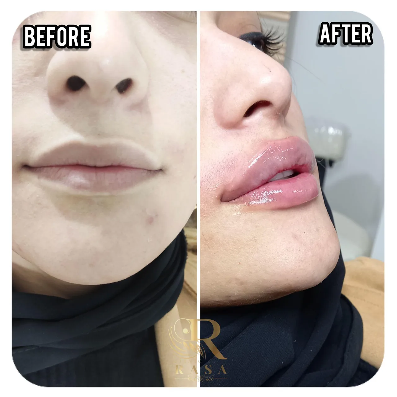 کلینیک زیبایی و پوست راسا - تصویر 3