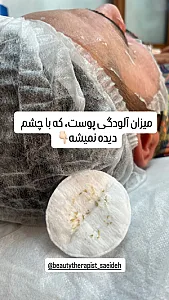 فیشال تخصصی  سعیده صدیقی