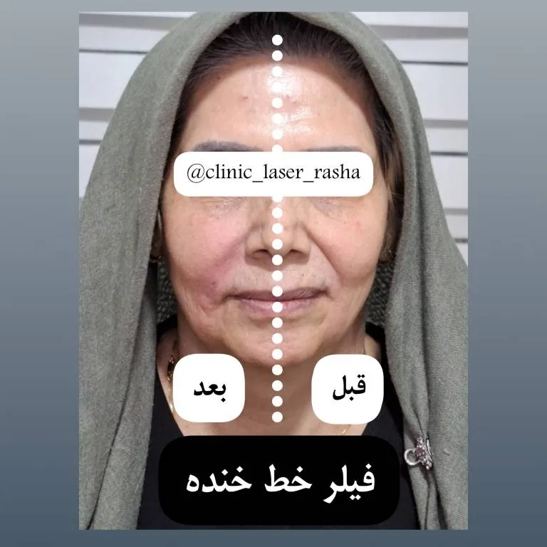 کلینیک لیزر و زیبایی راشا - تصویر 2