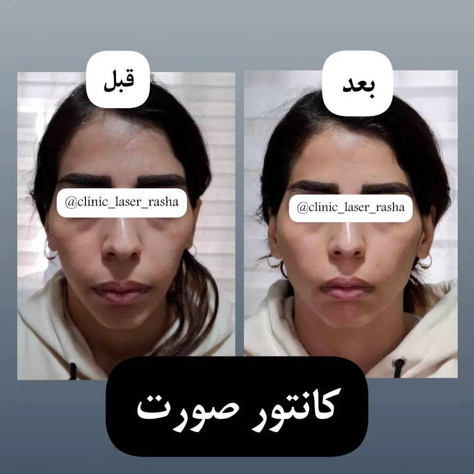 کلینیک لیزر و زیبایی راشا - تصویر 3