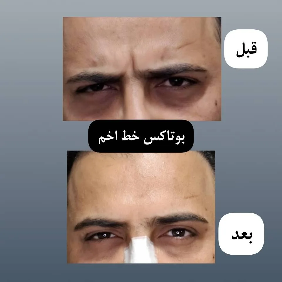 کلینیک لیزر و زیبایی راشا - تصویر 4