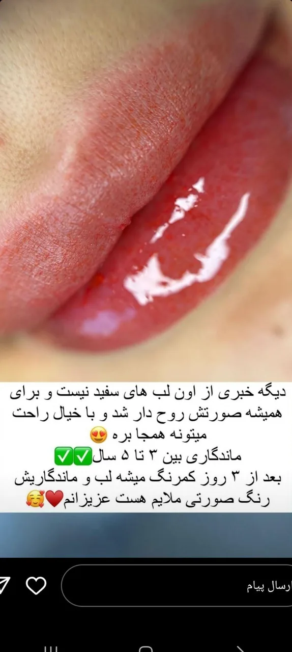 کلینیک پوست مو زیبایی و لیرز ماه بین - تصویر 4