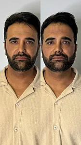 مرکز پوست و مو و لیزر  دلدار