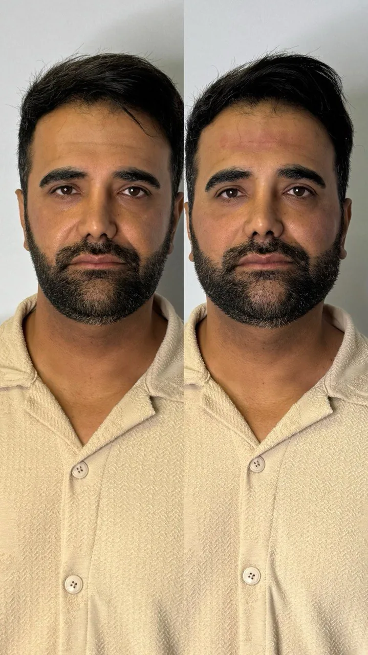 مرکز پوست و مو و لیزر  دلدار
