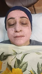 پاکسازی پوست و فیشال با کیمیا