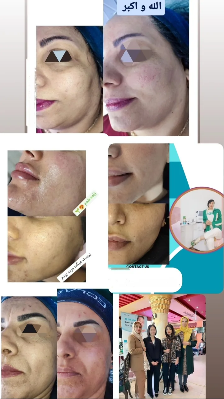 آموزش و انجام پاکسازی تخصصی پوست نیلوفر - تصویر 2