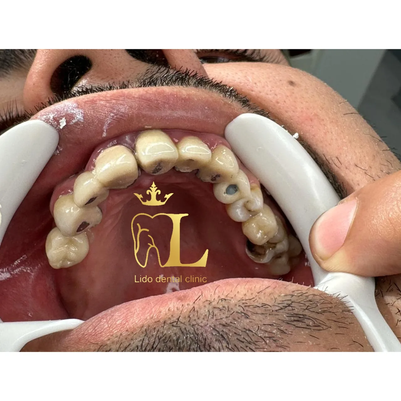 مرکز تخصصی دندانپزشکی لیدو - تصویر 4