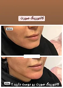 کلینیک پوست لیزر زیبایی لاغری سلین