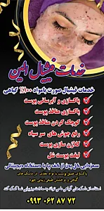 فیشیال پوست الین