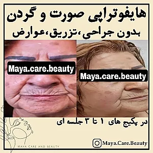 کلینیک پوست مو زیبایی و مرکز لاغری مایا