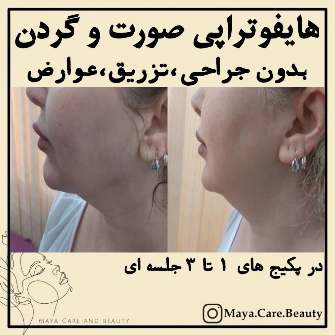 کلینیک پوست مو زیبایی و مرکز لاغری مایا - تصویر 2