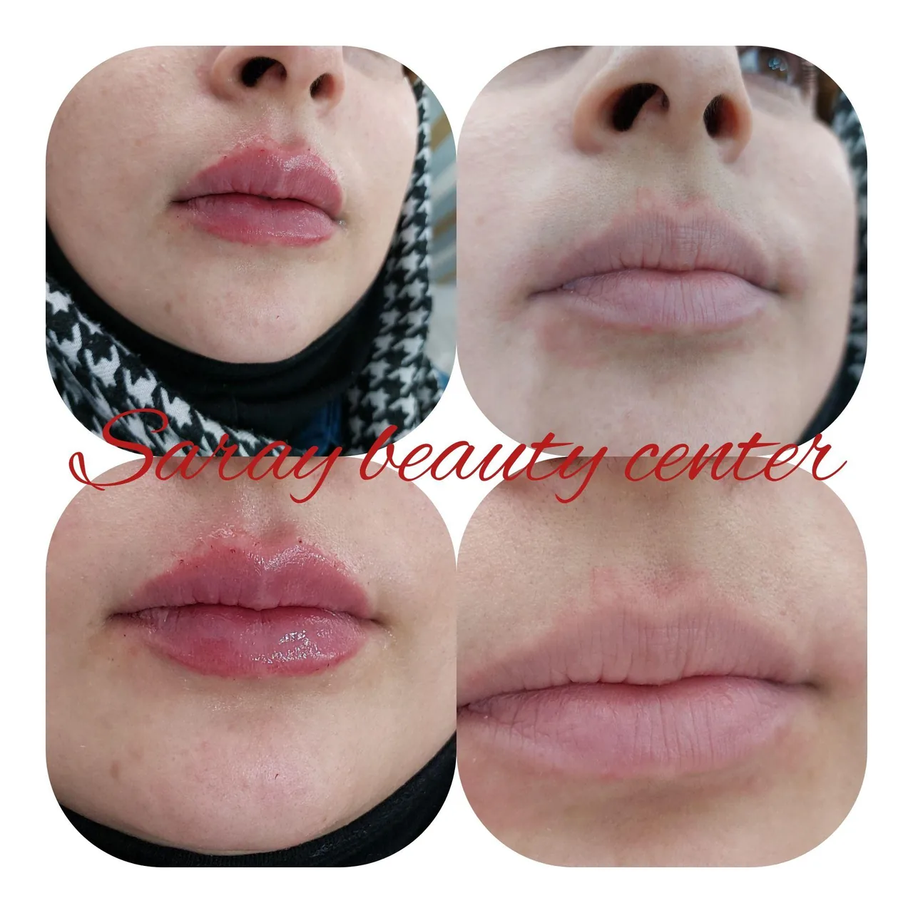 کلینیک پوست ، مو ، لیزر و زیبایی سارای - تصویر 2