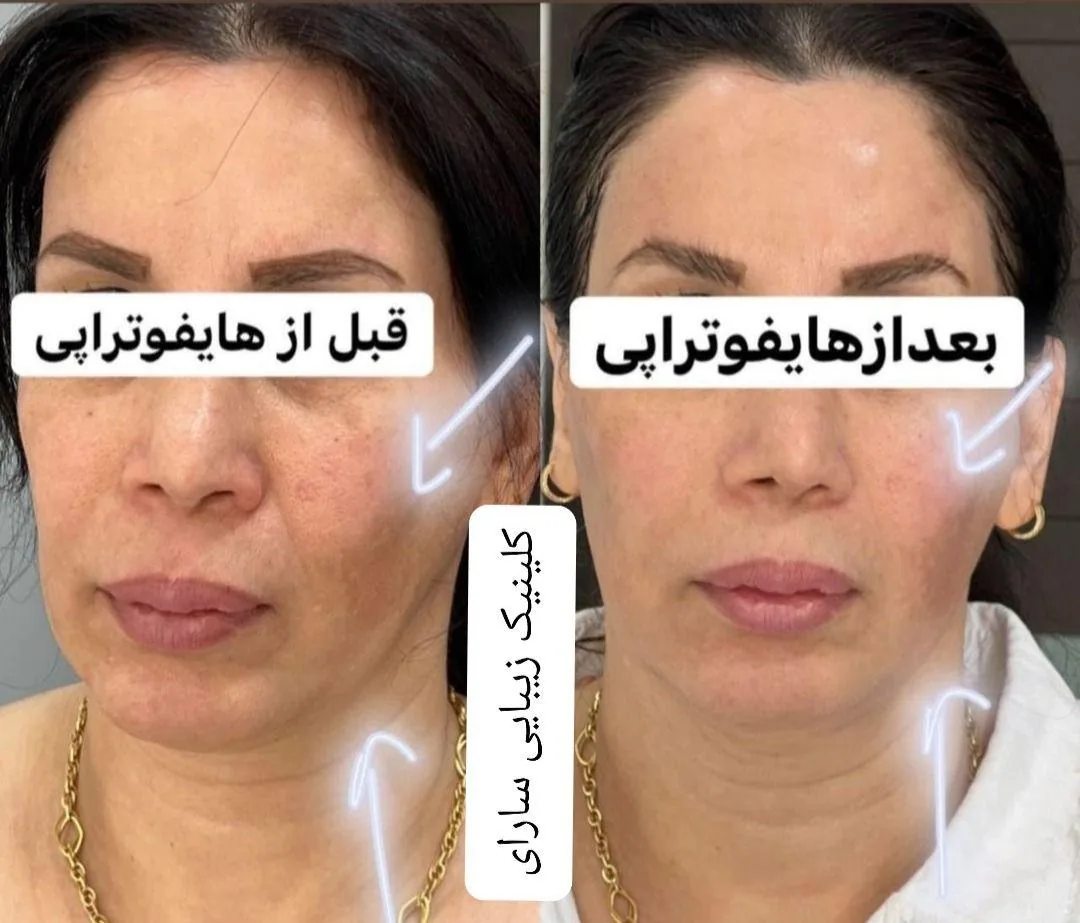 کلینیک پوست ، مو ، لیزر و زیبایی سارای - تصویر 4