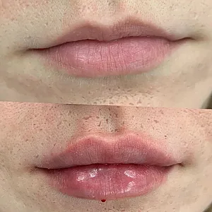 کلینک پوست مو زیبایی ونک