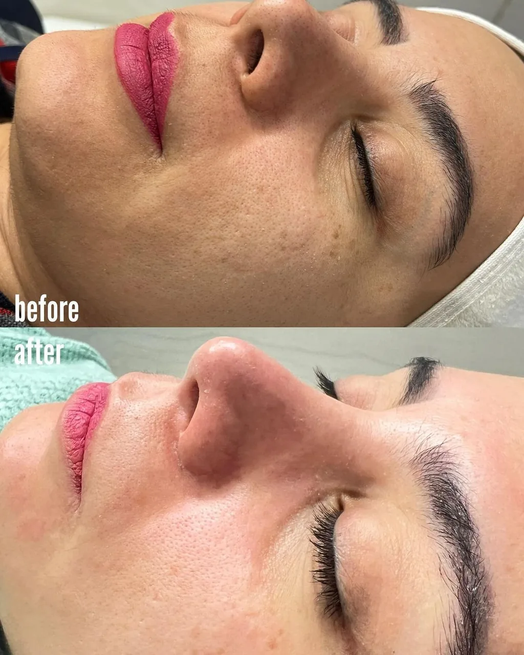 فیشال و پاکسازی پوست تخصصی بانوان نیلا