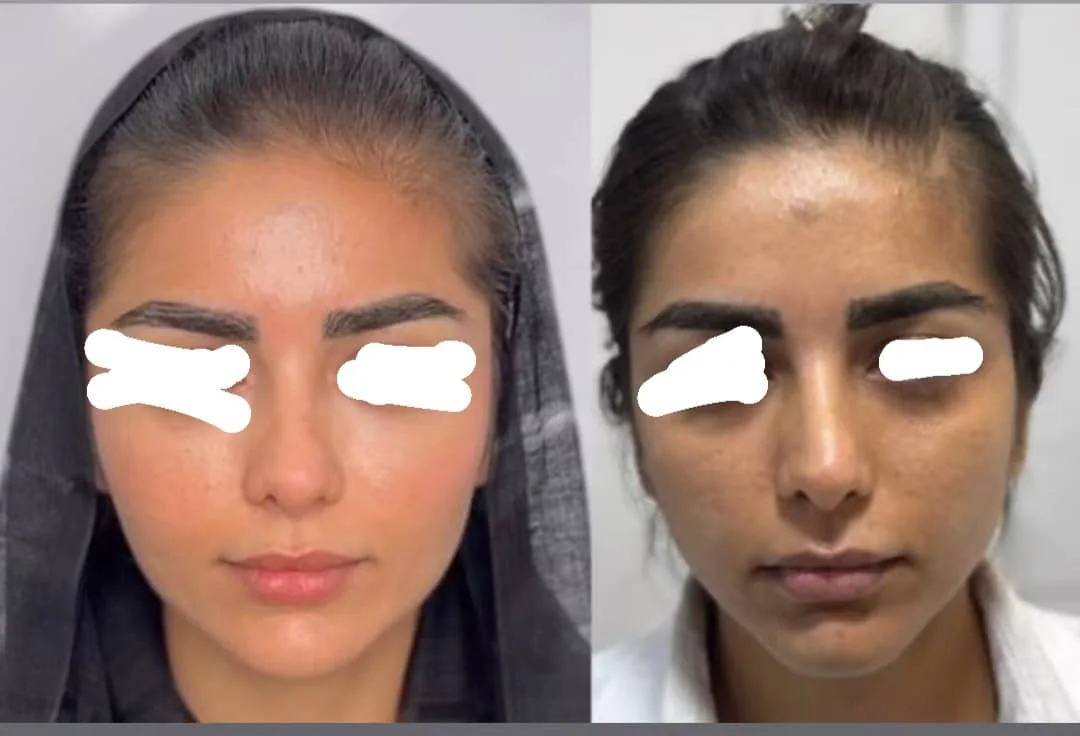 کلینیک زیبایی و مرکز لیزر موی زائد آریسا - تصویر 2