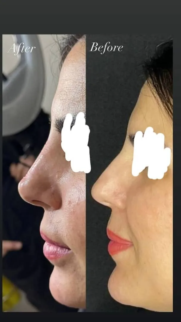 کلینیک زیبایی و مرکز لیزر موی زائد آریسا - تصویر 3