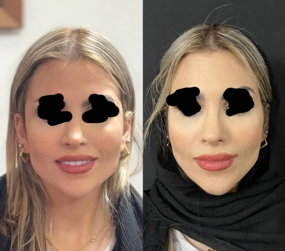 کلینیک زیبایی و مرکز لیزر موی زائد آریسا - تصویر 4