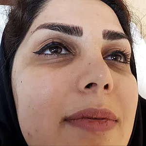 فیشیال و پاکسازی صورت مژگان