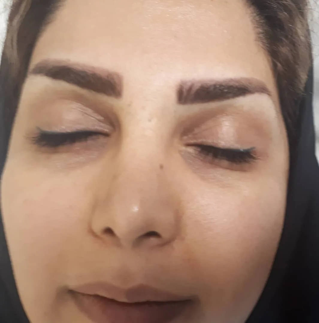 فیشیال و پاکسازی صورت مژگان - تصویر 2