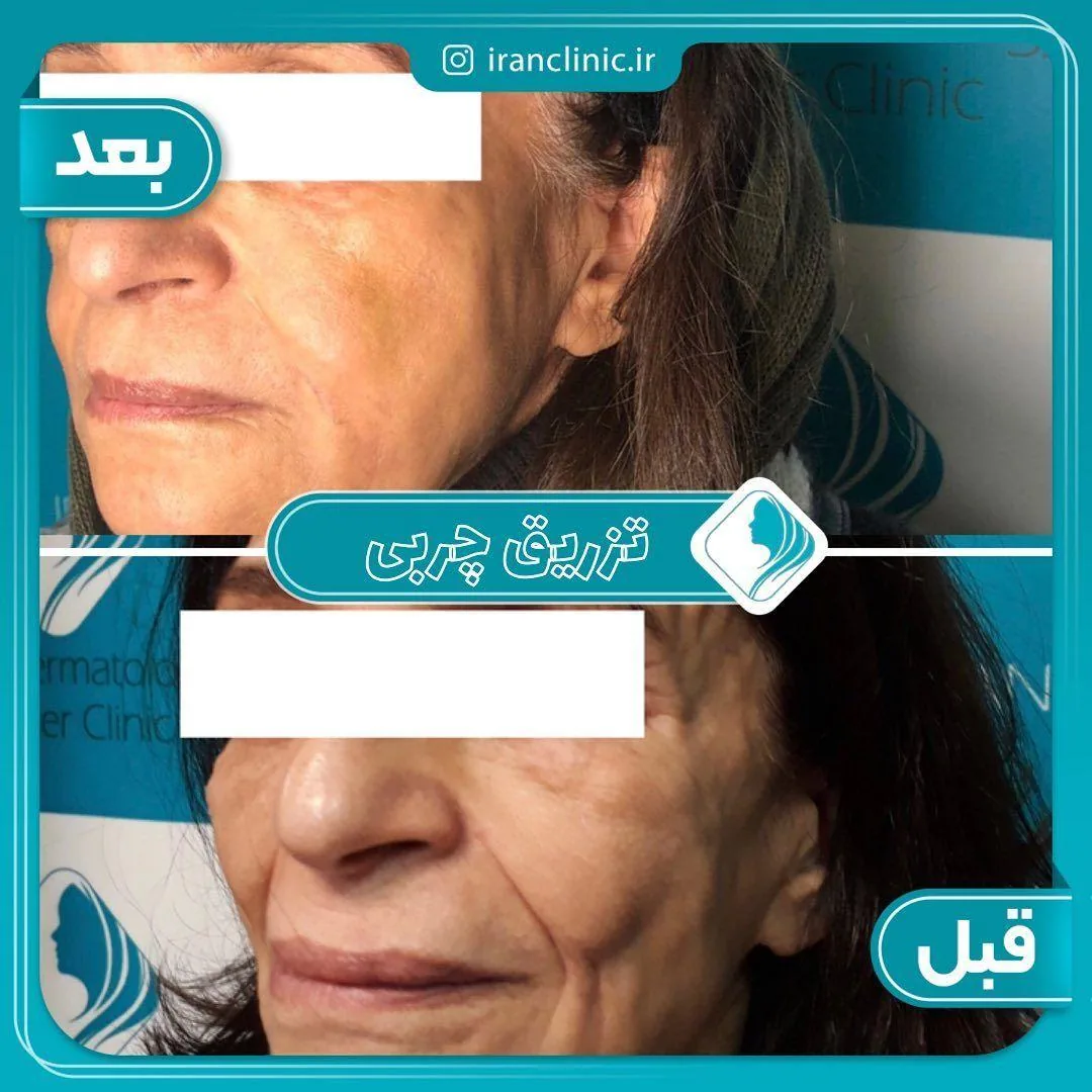 کلینیک تخصصی پوست، مو ،زیبایی ایران - تصویر 2