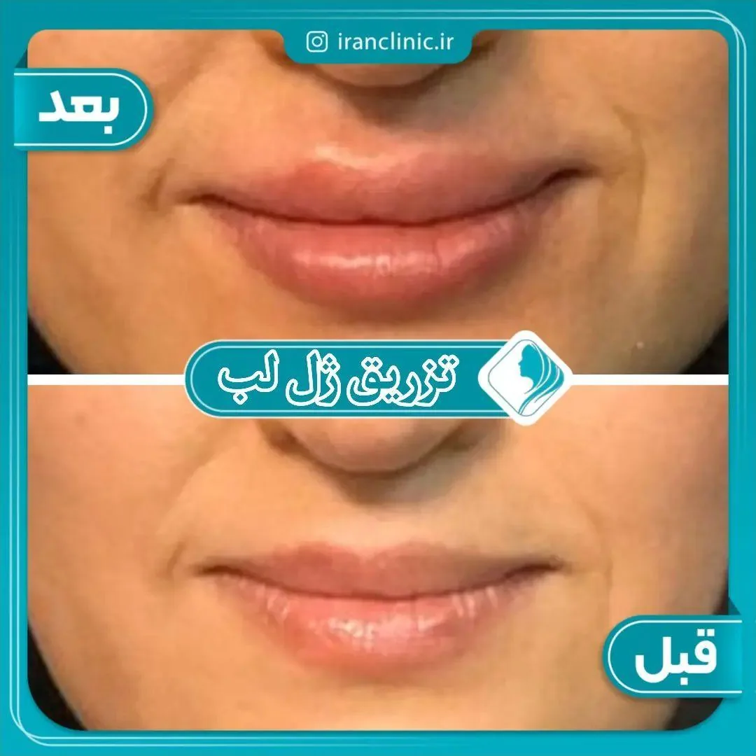 کلینیک تخصصی پوست، مو ،زیبایی ایران - تصویر 4