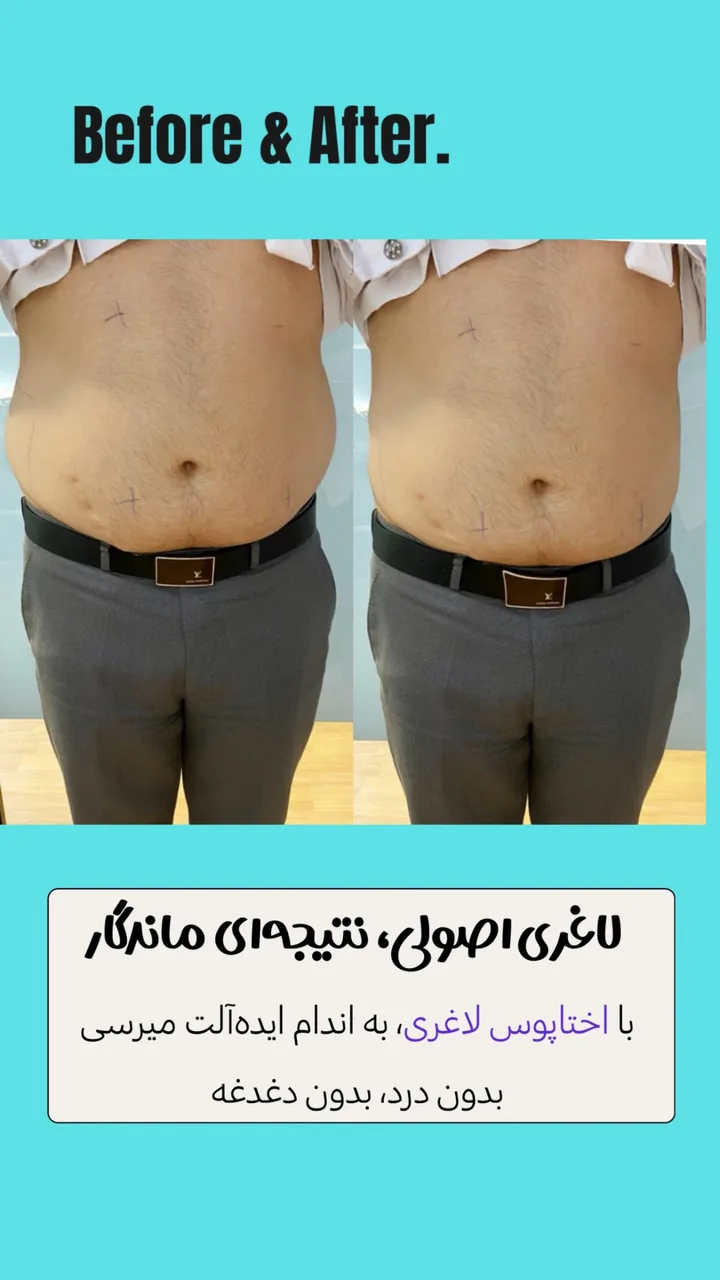 کلینیک زیبایی و لاغری الماس غرب