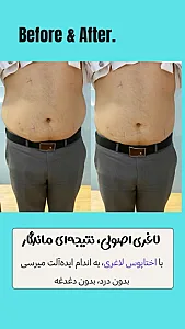 کلینیک زیبایی و لاغری الماس غرب