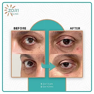 کلینیک زیبایی و لاغری زُروان