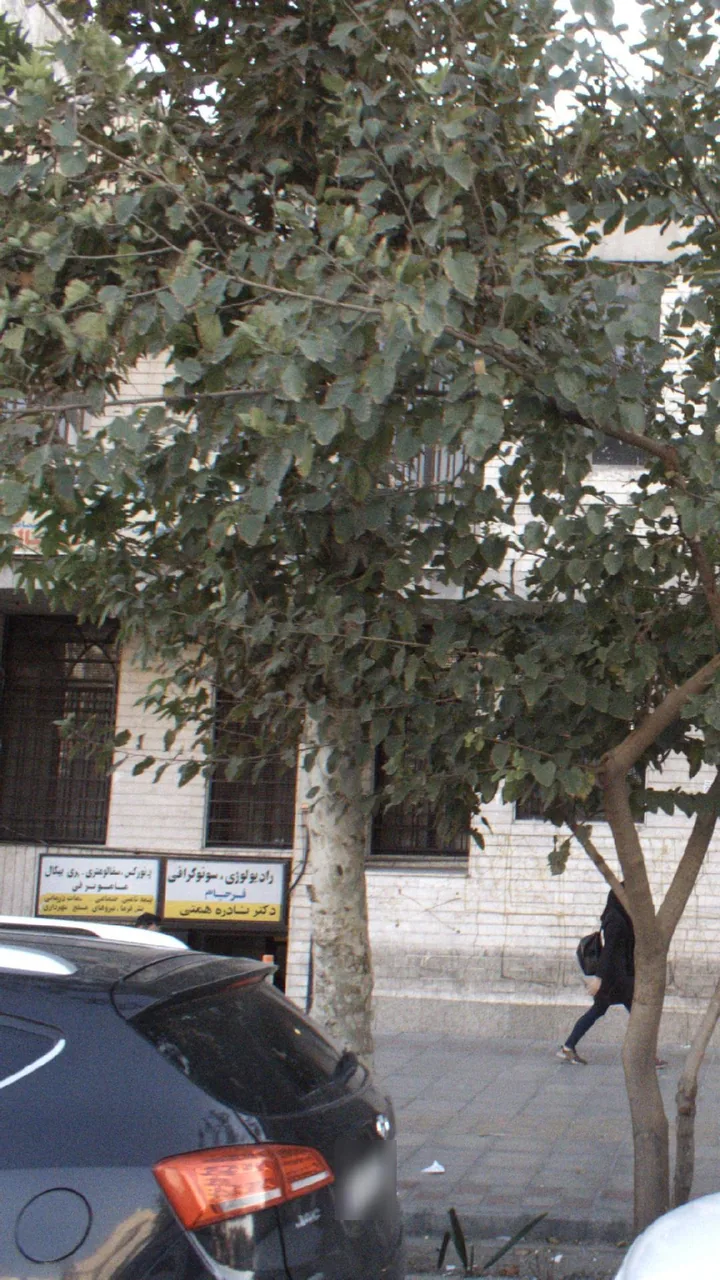 سفالومتری ماموگرافی