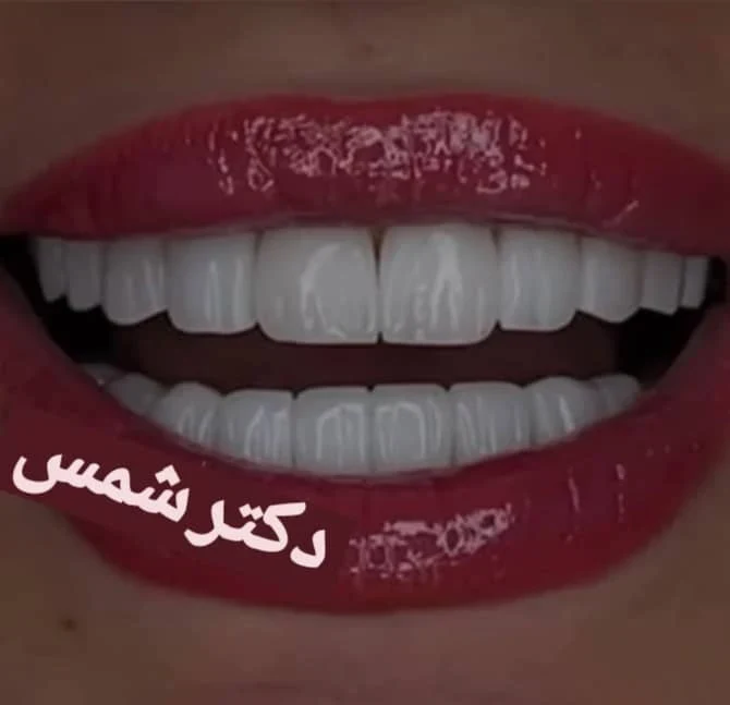 مرکز دندانپزشکی دکتر ساناز صراف شمس - تصویر 2